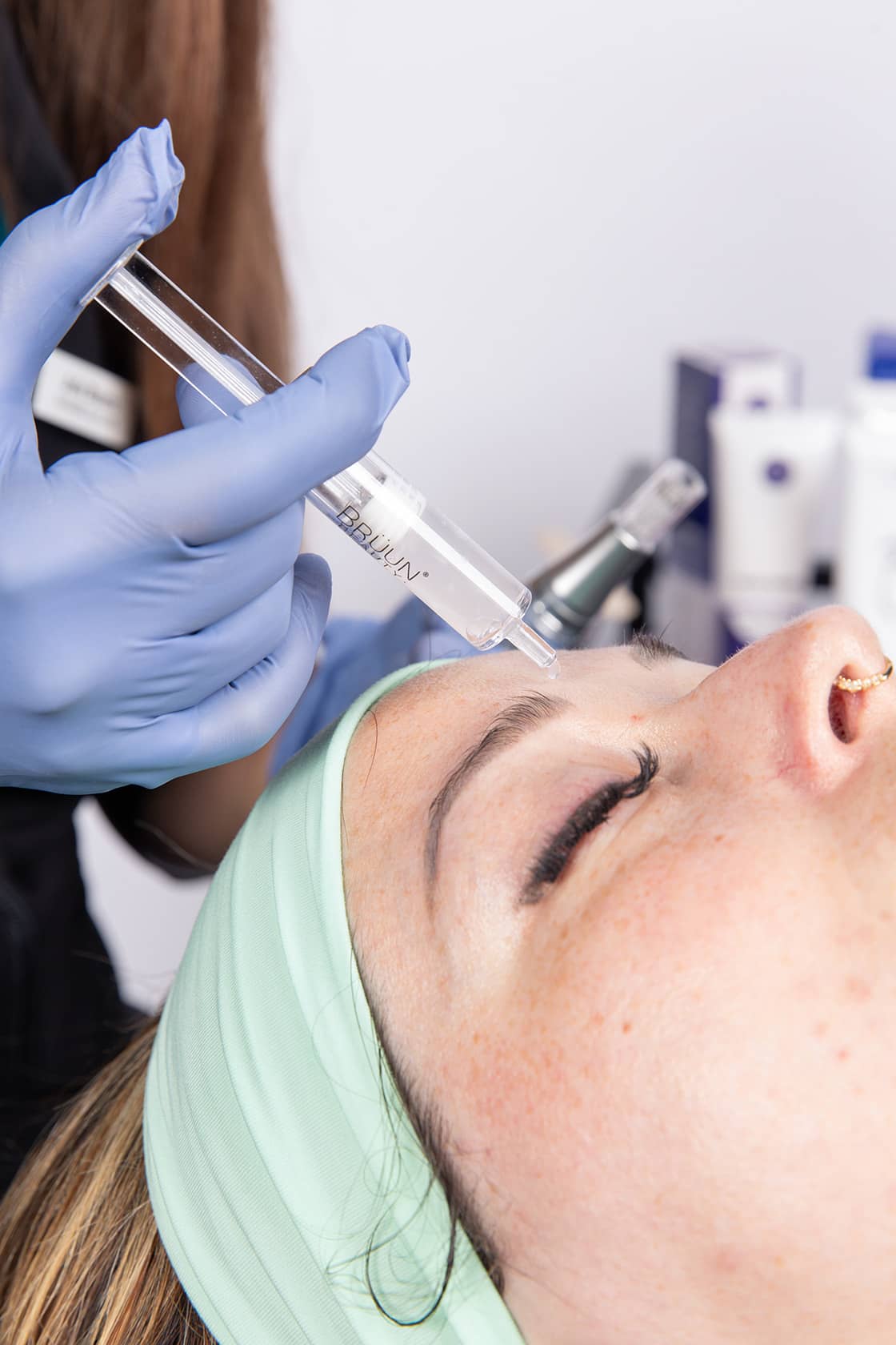 microneedling-02